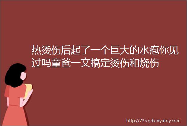 热烫伤后起了一个巨大的水疱你见过吗童爸一文搞定烫伤和烧伤